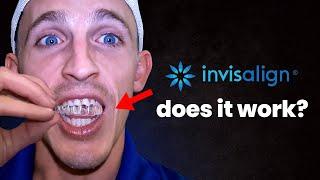 Watch this before you Buy Invisalign…Orthodontist reviews