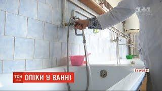 Через недогляд в Ладижинському інтернаті підопічна з ДЦП зазнала тяжких опіків
