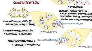 Charcot - Marie Tooth Disease