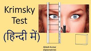 Krimsky Test in Hindi | Krimsky Test | Prism Bar Reflex Test | PBRT | Modified Hirschberg test