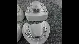 5 Star Dental Lab Unboxing- Fixed RPE Twin Block- Metal 3D Printed