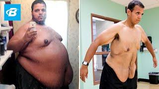 The Incredible Shrinking Man | Jesse Shand Lost 350 Pounds