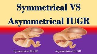 Symmetrical and Asymmetrical IUGR Differences : Symmetrical Vs Asymmetrical IUGR