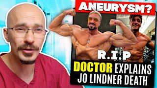 DOCTOR Explains Jo Lindner "Joesthetics" Death || Aneurysm ???