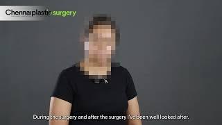 Breast Reduction - Testimonial - Dr. Karthik Ram - Chennai Plastic Surgery