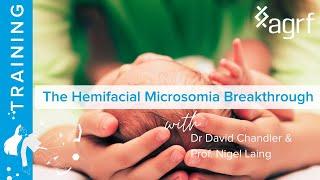 Hemifacial microsomia: Dr David Chandler + Professor Nigel Laing on finding a genetic answer at last