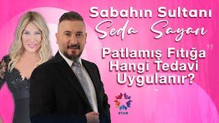 Op. Dr. Fatih Kırar | Sabahın Sultanı Seda Sayan | Patlamış Fıtığa Hangi Tedavi Uygulanır?