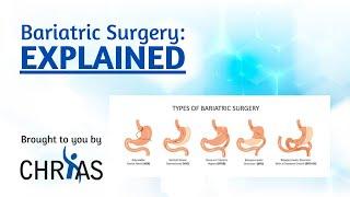 Bariatric Surgery: Explained