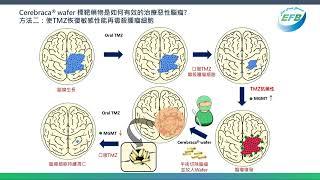 Cerebraca® Wafer 如何治療腦癌?