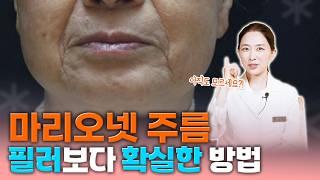 절대 필러로 채우지 마세요! 40대 슈퍼동안의사의 ‘마리오넷주름 없애는 가장 확실한 방법’