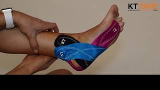 Tape It Tuesday - Plantar Fasciitis