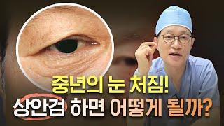 50대 이상 남성 눈꺼풀 처짐으로 쌍꺼풀 실종되었다면?