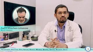 Foreigner Patient Hair Transplant In India | Hairfree & Hairgrow Clinic Surat | Best Result