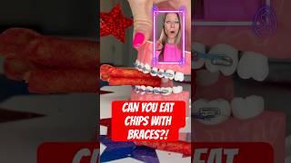 CAN YOU EAT CHIPS WITH BRACES? Orthodontist REACTS #braces #chips #asmr
