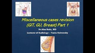 Miscellaneous Cases Revision GI, GU & Breast (Part 1)