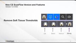 CS ScanFlow - Soft Tissue Removal Feature