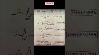 Simple ECG #medstudent #science #nurse #viralvideo #ecg #cardiology #anatomy