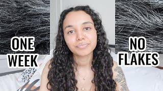 Heal DRY Scalp FAST | Scalp Routine