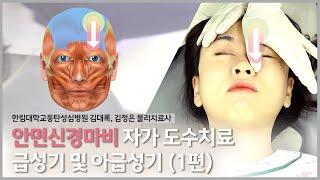 안면신경마비 자가 도수치료 – 급성기 및 아급성기 (1편)