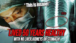 Living 50 Years Without Organs: Doctor Stunned After Examining This Man's Belly!