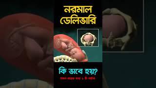নরমাল ডেলিভারি কি ভাবে হয়?Normal delivery #shorts