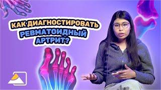 Почему важна ранняя диагностика ревматоидного артрита?