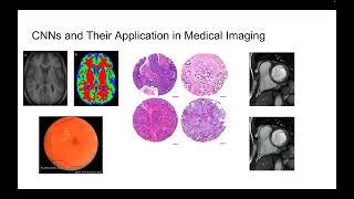 Deep Convolutional Classifiers for Colon Tissue Histopathology Imaging - Amir Hossein Akbarnejad