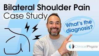 Bilateral Shoulder Pain Case Study | Expert Physio explains assessment, diagnosis and treatment!