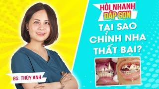 Tại sao niềng răng thất bại?