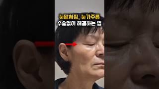 굵은 눈가주름, 눈밑꺼짐 집에서 해결하는 방법! 아이팔트 아이백크림으로 움푹패인 주름을 채워주세오. 🩵구매링크는 게시글 참고해주세요🩵 #주름 #주름없애는법 #눈가주름 #눈밑주름