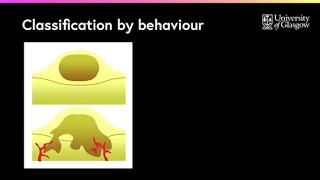 What are the differences between benign & malignant tumours?