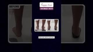 How We Help for your Flat Feet Recovery?