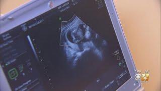 Texas' Heartbeat Law Stands After No Action By Supreme Court