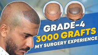 Hair Transplant in Ahmedabad | Best Results & Cost of Hair Transplant in Ahmedabad