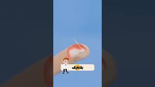 ماذا يحدث لو دخلت شظية من عظمك في إصبعك؟ الحقيقة أغرب مما تتخيل!#shorts