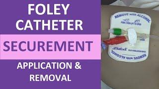 Foley Catheter: How to Secure with StatLock Stabilization Device (Apply & Remove Nursing)