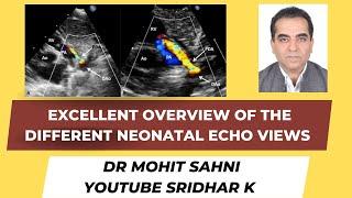 Neonatal echo-an excellent overview of how to obtain the basic views. Dr Mohit Sahni #pocus #echo