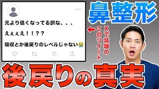 【鼻整形】鼻中隔延長を受けても後戻りすることはあり得るのか