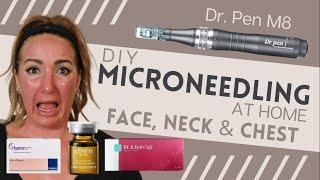 DIY Microneedling at home with the Dr. Pen M8, Rejuran. Hyaron and Placenta Extract. Anti-aging