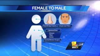 Gender reassignment surgery extremely complicated