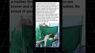 The Silent Strength of C-Section Mom
