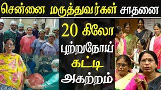 In rare surgery, Chennai doctors removes 20 kg tumour  for 51 year lady