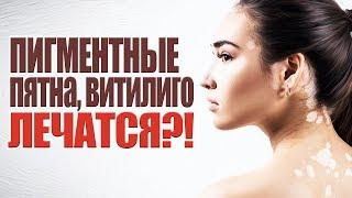 Пигментные пятна, капилляры, ВЕСНУШКИ, витилиго как лечить?!