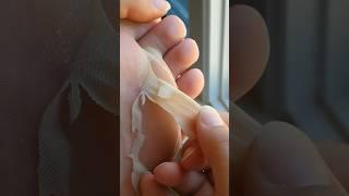 Foot Peel Mask for baby soft feet and no more cracked heels or calluses  How To Get Rid of Dry Feet