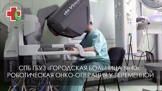 Городская больница №40: Роботическая онко-операция у беременной