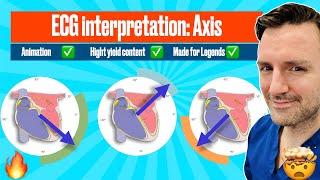 Cardiac Axis! A visual guide