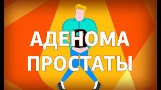 ЛЕЧЕНИЕ АДЕНОМЫ ПРОСТАТЫ