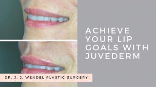 Juvederm Lip Filler Patient Journey Video Vlog | Dr. J. J. Wendel Plastic Surgery