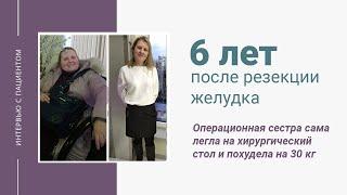 6 лет после резекции желудка для похудения