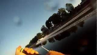 ( Doug ) Waterski